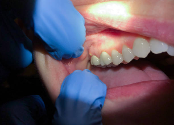 Best Emergency TMJ Treatment in Cibolo, TX