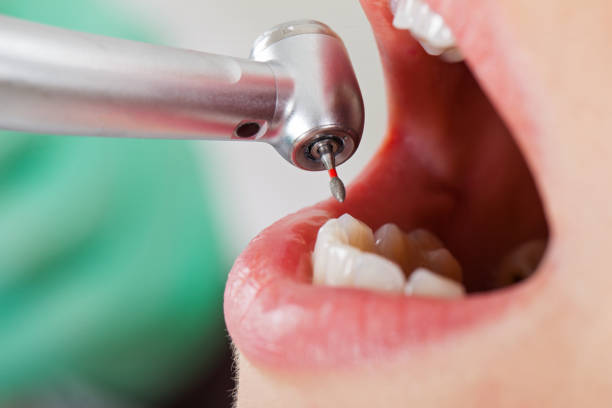 Best Weekend Emergency Dentist in Cibolo, TX